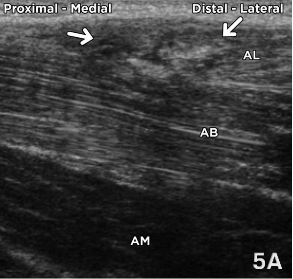 A close-up of an ultrasound AI-generated content may be incorrect.