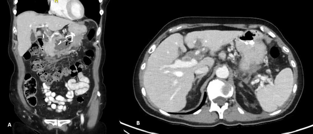 A close-up of a ct scan AI-generated content may be incorrect.