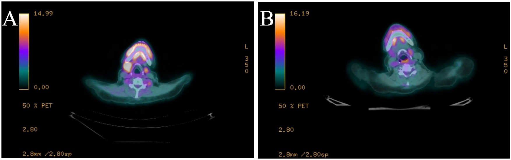 A close-up of a x-ray AI-generated content may be incorrect.
