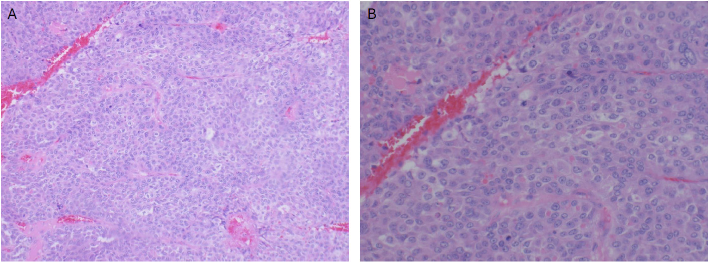 A close-up of a microscope AI-generated content may be incorrect.