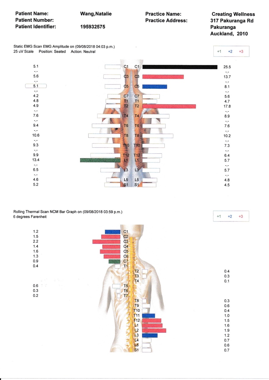 REDUCED ANXIETY SYMPTOMS IN A PATIENT SCREENED WITH THE PHQ4