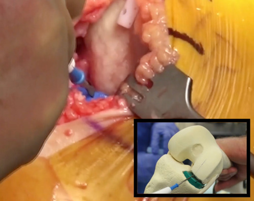 A close-up of a person's mouth AI-generated content may be incorrect.