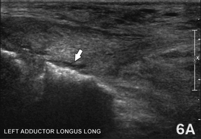 An arrow pointing at a large area of the skin AI-generated content may be incorrect.