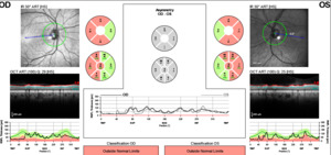 Case Report: Traumatic Optic Neuropathy Secondary to Gun Shot Wound ...