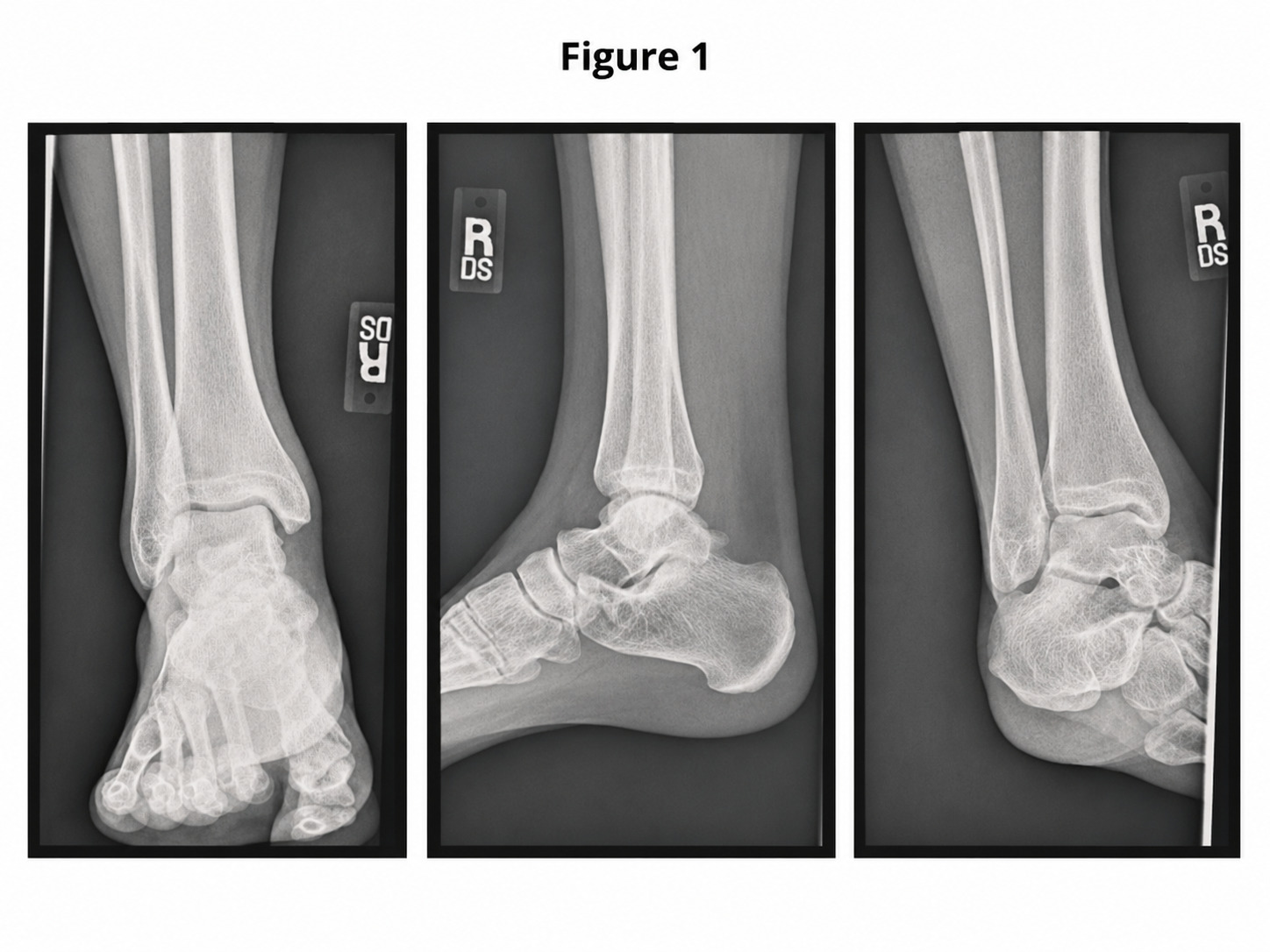 Figure 1