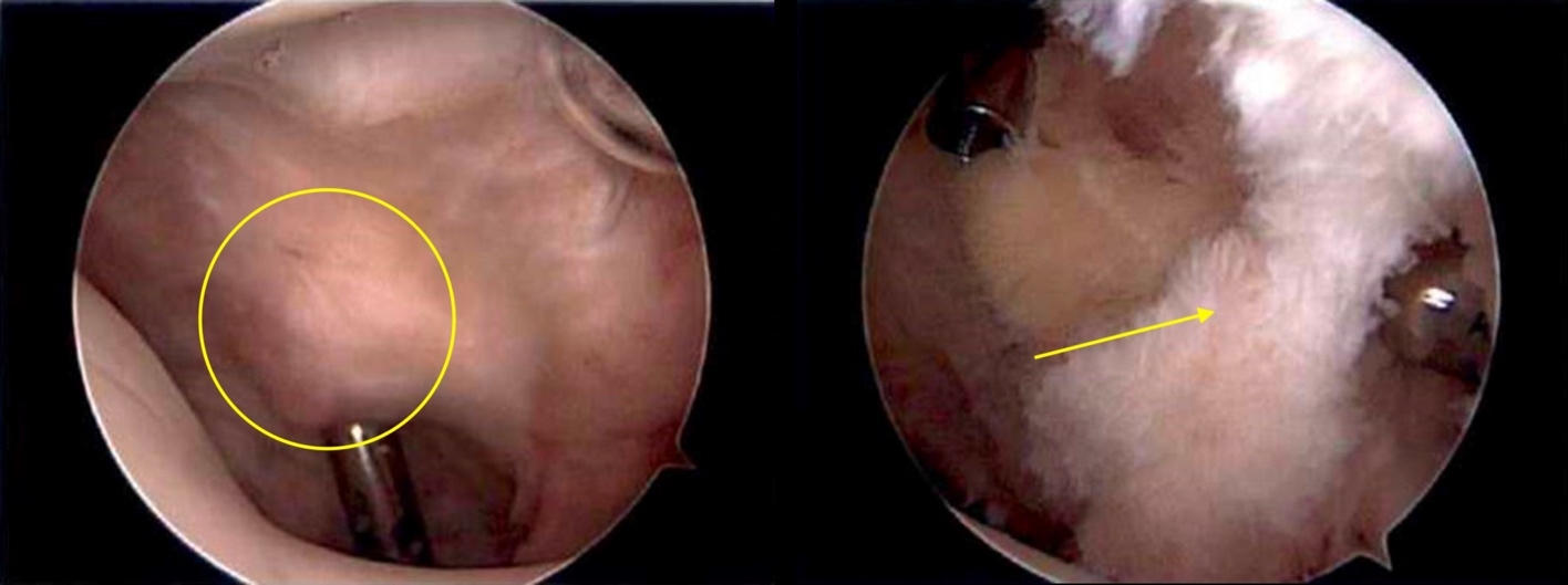 A close-up of a person's face AI-generated content may be incorrect.