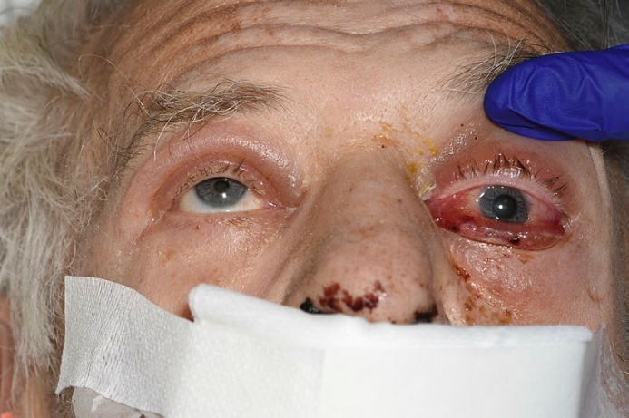 A close-up of a person's eye Description automatically generated