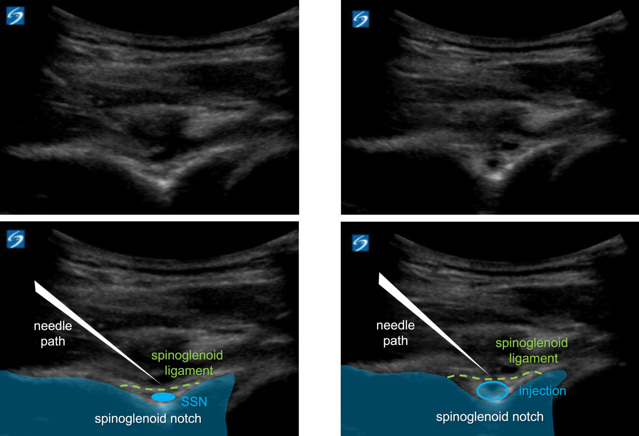 A close-up of ultrasound images AI-generated content may be incorrect.
