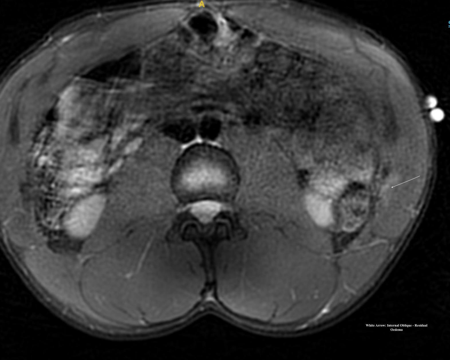A close-up of a ct scan Description automatically generated
