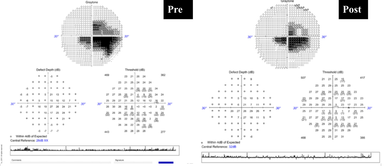 A screenshot of a graph AI-generated content may be incorrect.