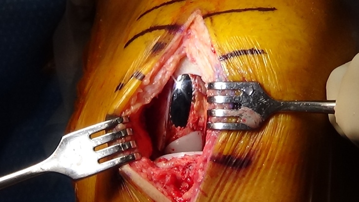 A close-up of a human eye AI-generated content may be incorrect.