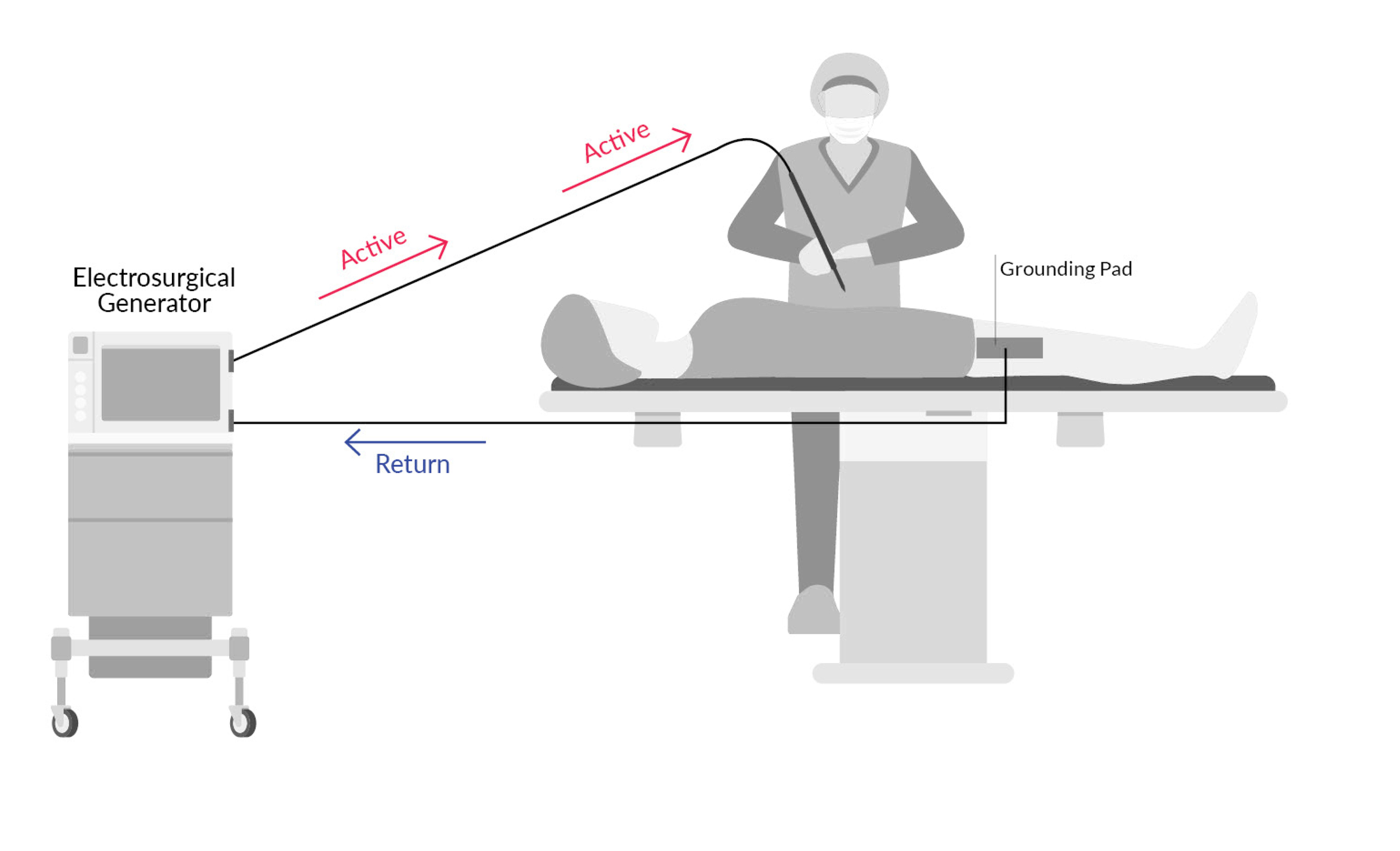 Figure 1. Illustration of Monopolar Electrosurgery.