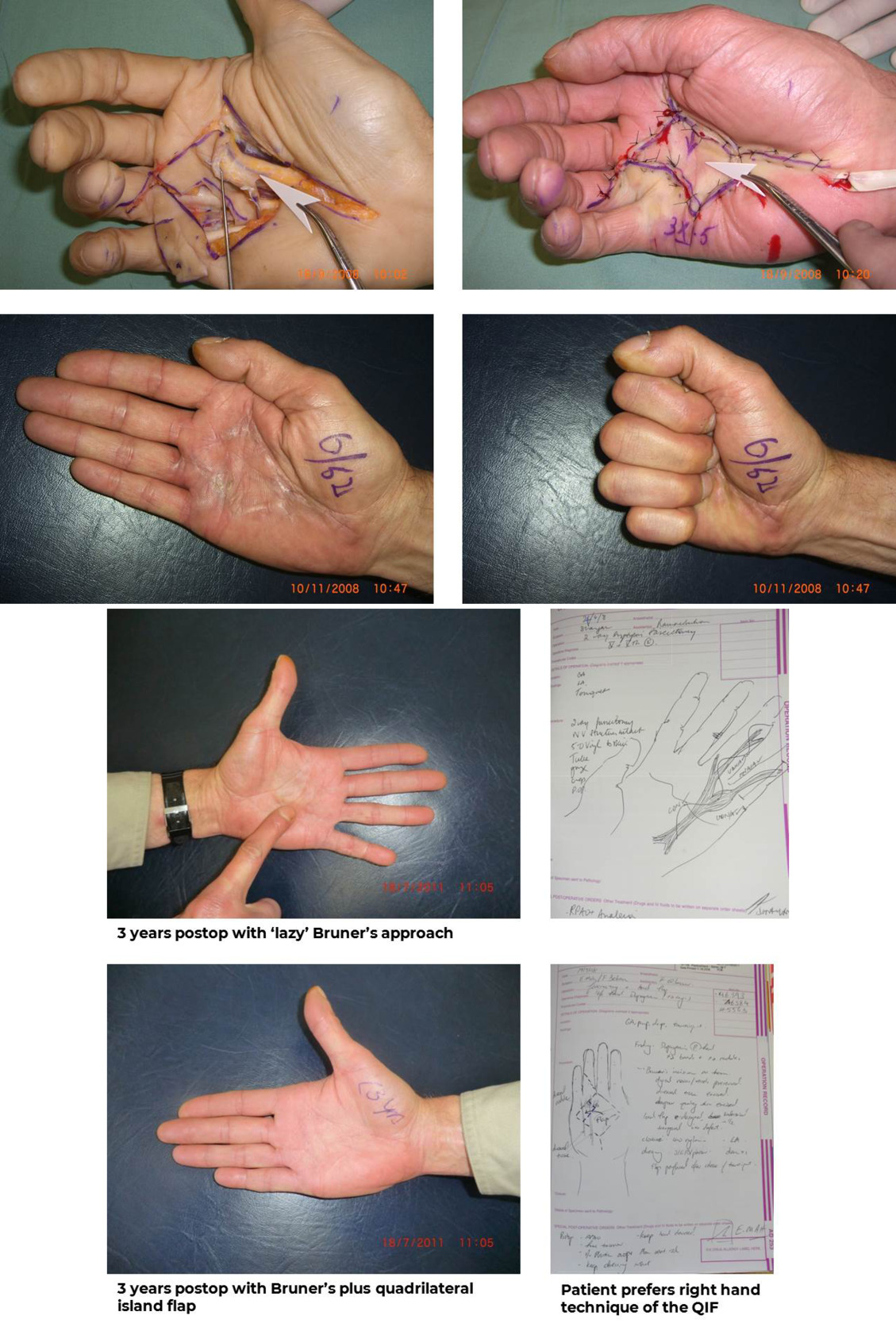 Case 10