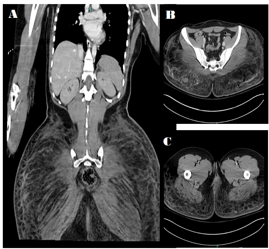 A close-up of a chest x-ray Description automatically generated