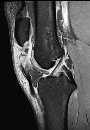 A close-up of a knee Description automatically generated