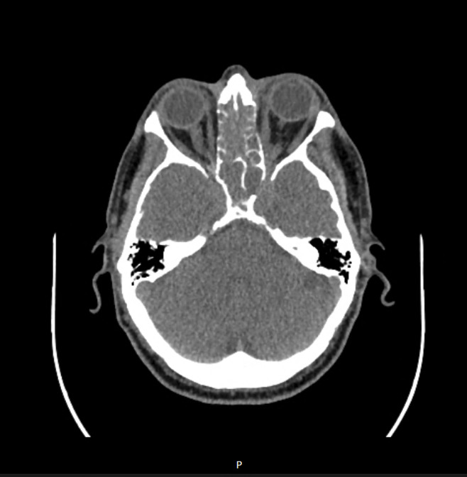 A close-up of a brain Description automatically generated