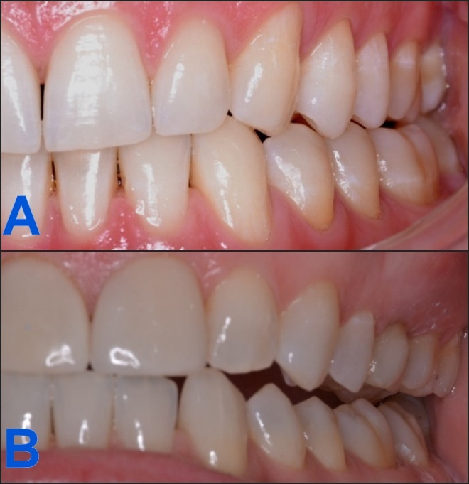 Close-up of teeth AI-generated content may be incorrect.