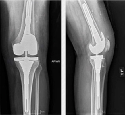 X-ray of a knee joint AI-generated content may be incorrect.