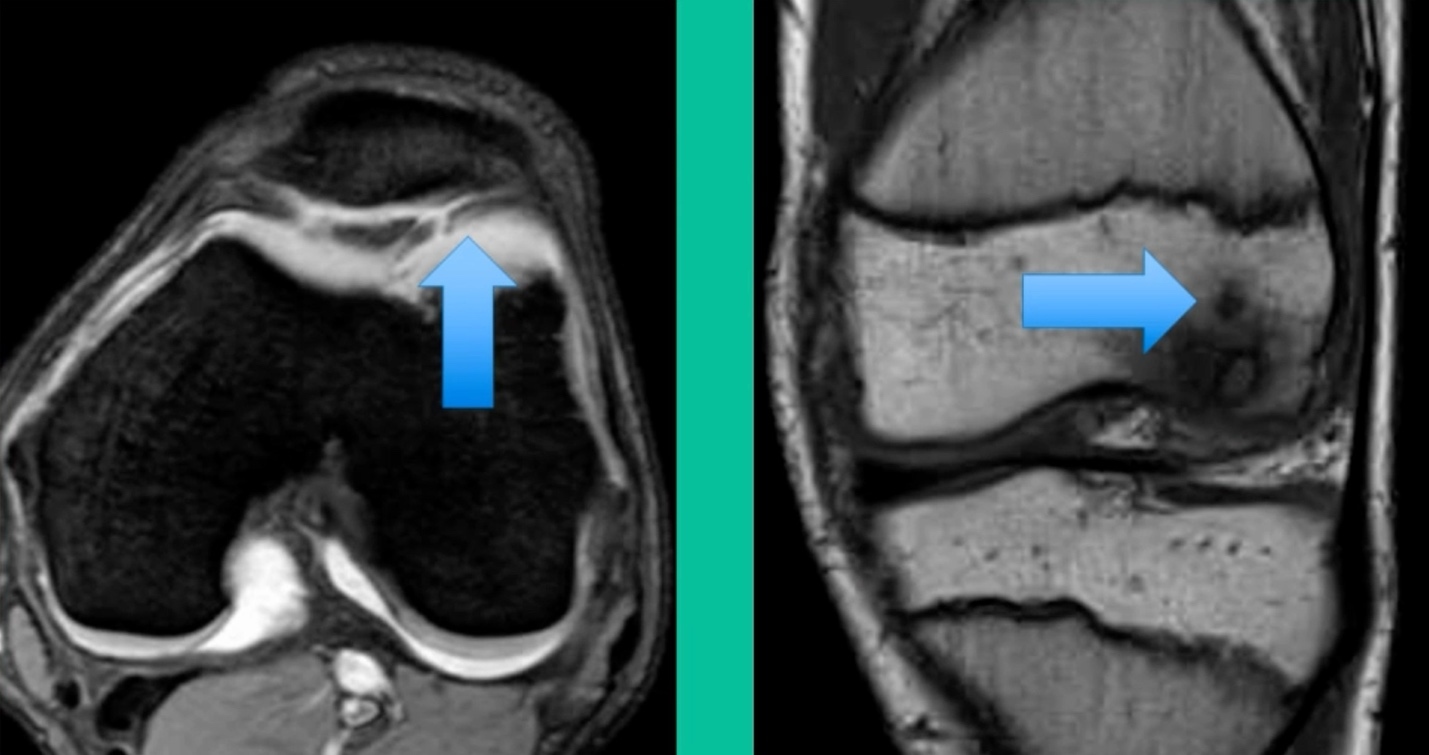 A close-up of a mri scan AI-generated content may be incorrect.