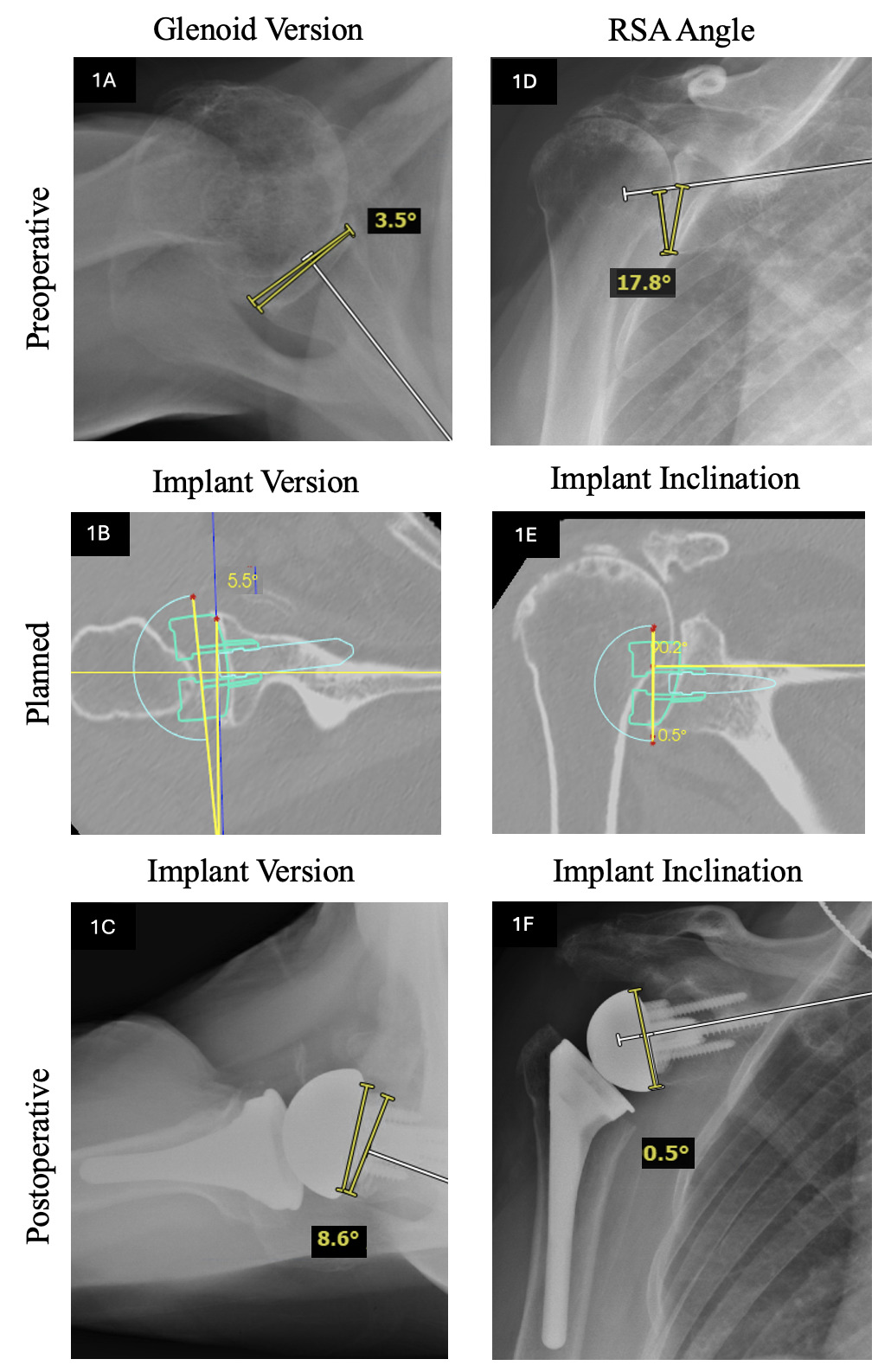 X-ray images of a bone Description automatically generated