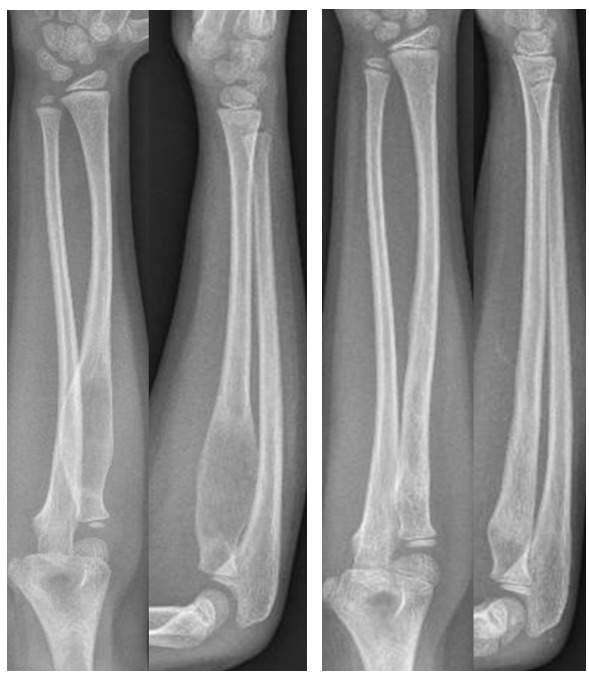 A close-up of a bone AI-generated content may be incorrect.