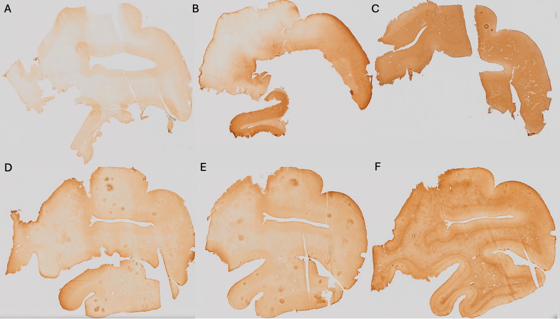 A collage of images of a person's body AI-generated content may be incorrect.