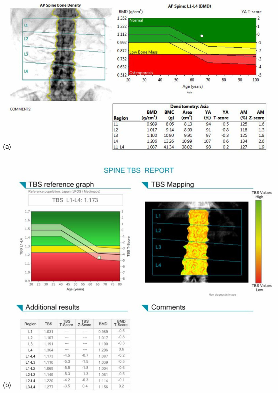 A screenshot of a medical report AI-generated content may be incorrect.
