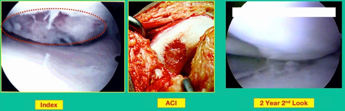 A collage of images of a person AI-generated content may be incorrect.