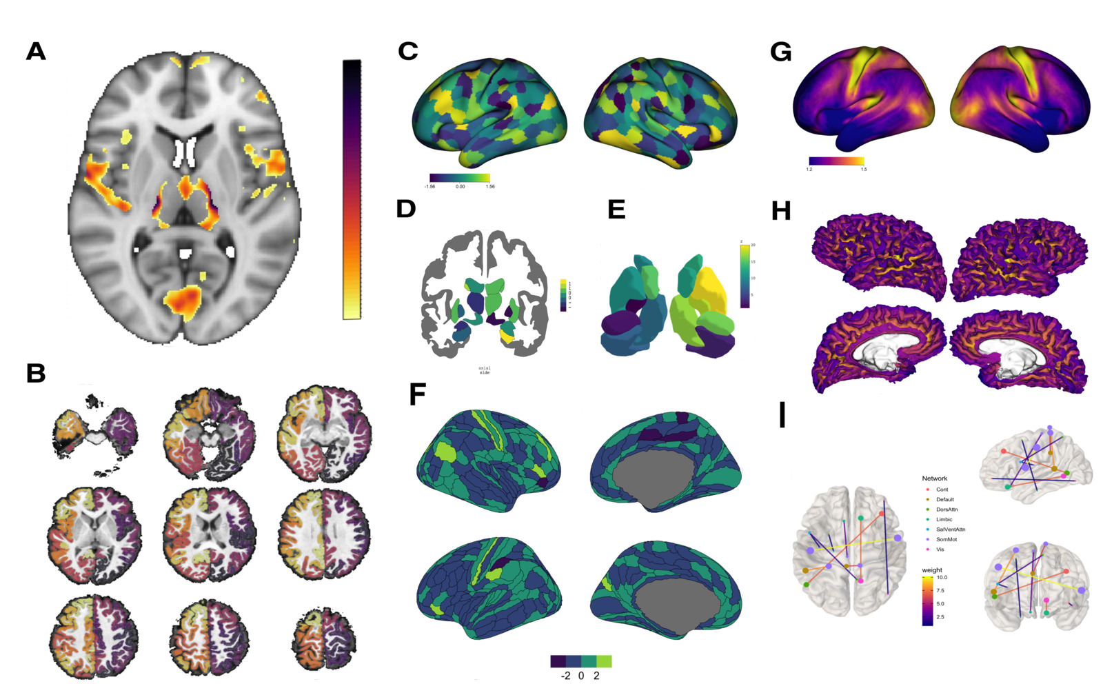 コンピュータ・IT Neuroimaging Methods and Applications A Practical Guide for Generating Reproducible and Programmatic