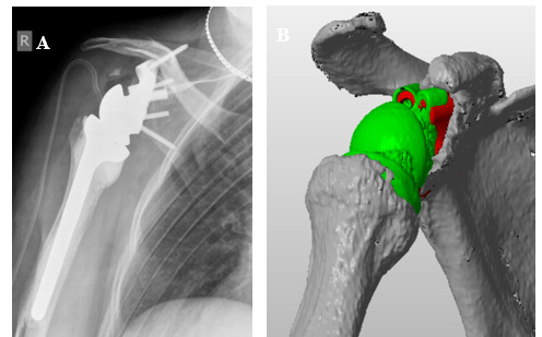 Figure 13