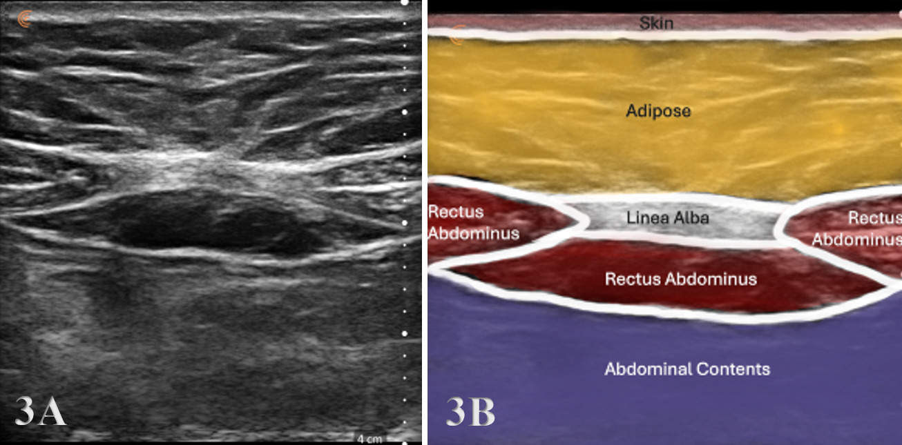 A close-up of a medical scan AI-generated content may be incorrect.