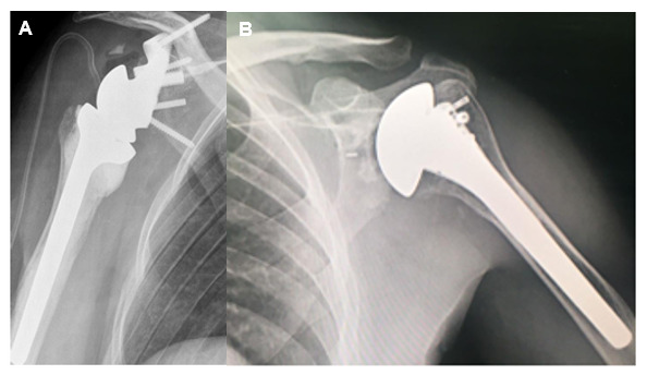 Figure 18