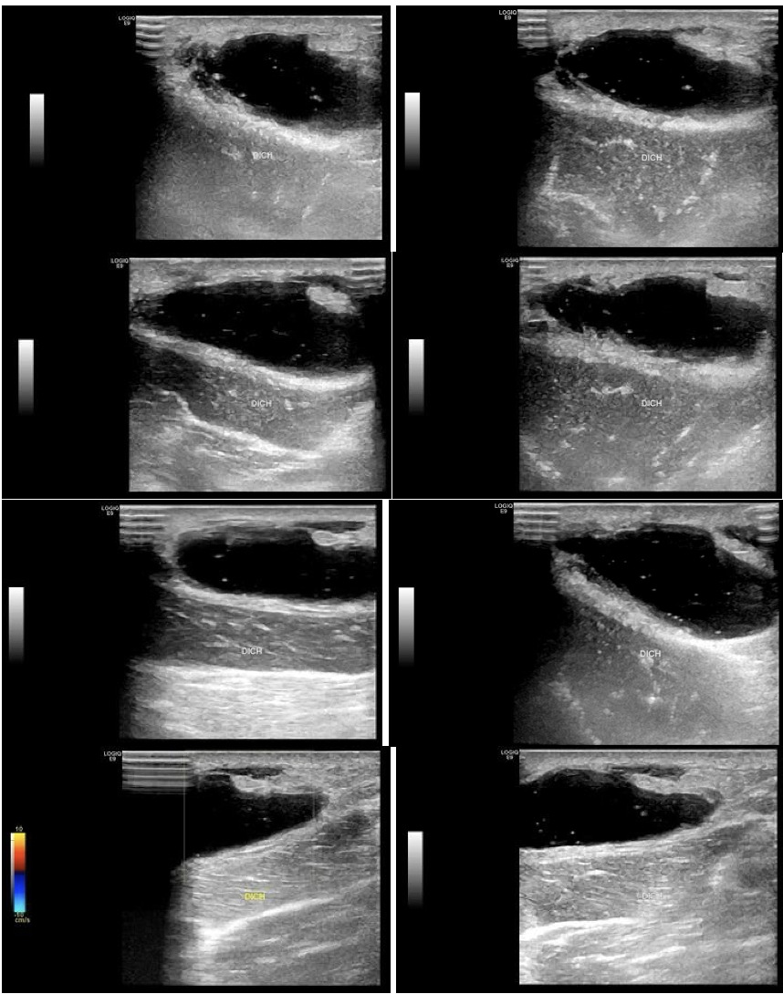 A collage of images of a person's body Description automatically generated