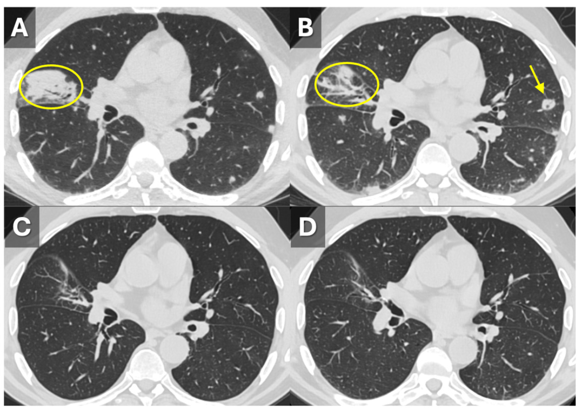 A close-up of a ct scan AI-generated content may be incorrect.