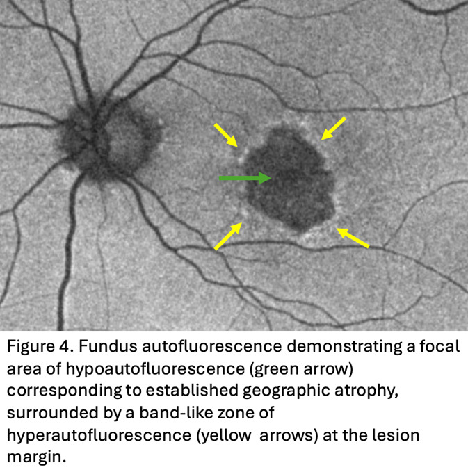 A close-up of a microscope AI-generated content may be incorrect.