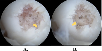 Figure 14