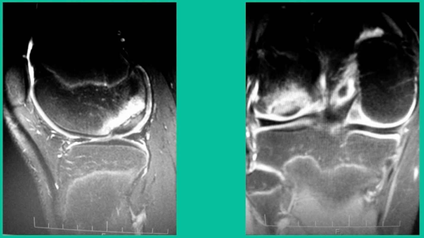 A close-up of a mri scan AI-generated content may be incorrect.