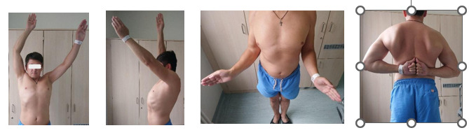 Figure 14