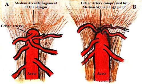 A drawing of red animals AI-generated content may be incorrect.