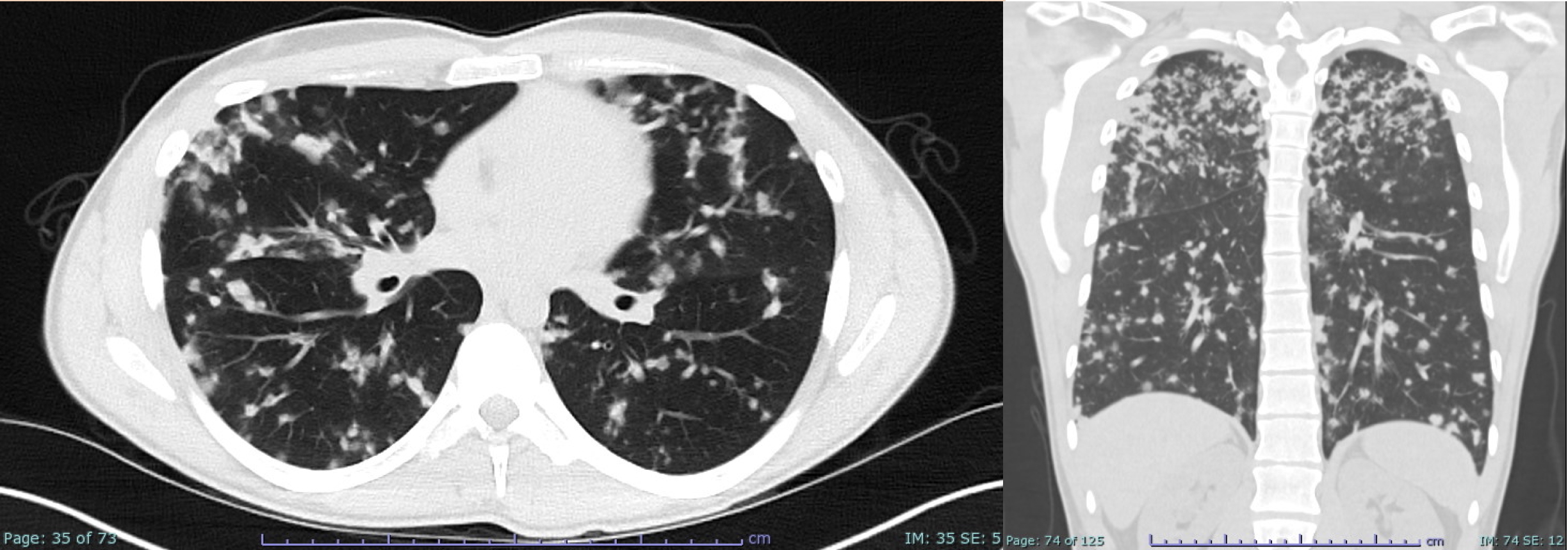 A close-up of a chest x-ray Description automatically generated