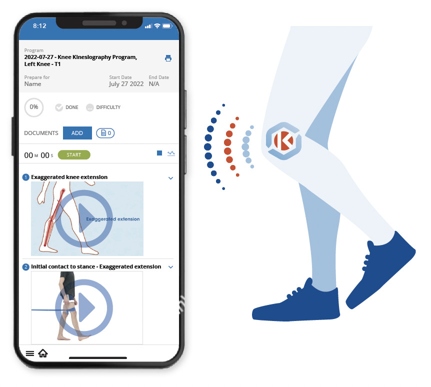 A New Paradigm in the Management of Knee Osteoarthritis and ...
