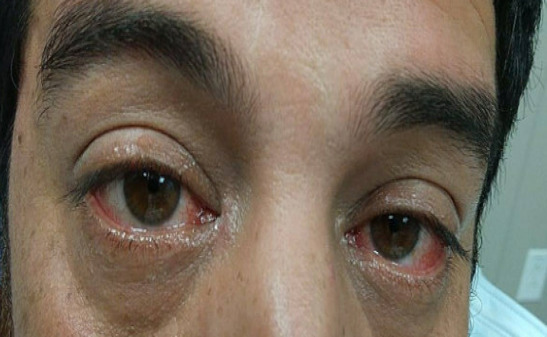 A close-up of a person's eyes AI-generated content may be incorrect.