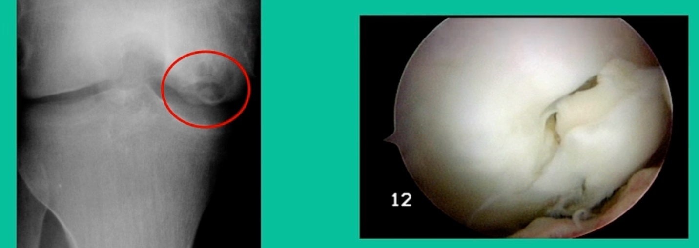 A close-up of a white ball AI-generated content may be incorrect.