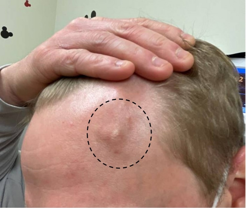 A person's head with a circle drawn on it AI-generated content may be incorrect.