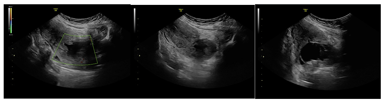 A ultrasound image of a baby AI-generated content may be incorrect.