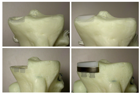 A close-up of a model of a human bone AI-generated content may be incorrect.