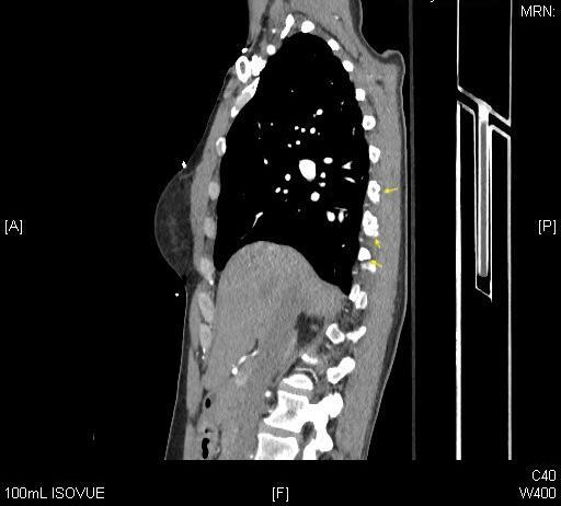 A close-up of a ct scan Description automatically generated