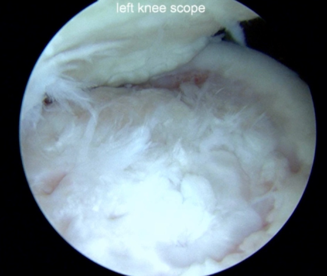 A close-up of a white feathered object AI-generated content may be incorrect.