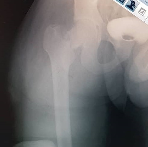 X-ray of a person's body AI-generated content may be incorrect.