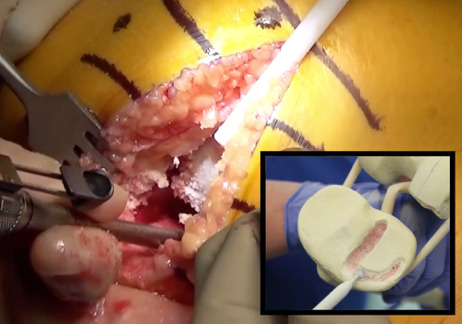 Close-up of a person's hand AI-generated content may be incorrect.